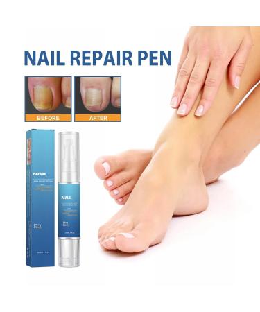 Nail Thickening Soft Gel for Damaged & Cracked Nails - Easy to Use 3ml | Pink - International Shipping - Buy Online on GoSupps.com