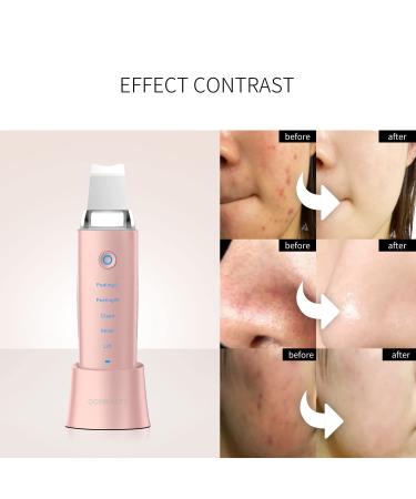 COSBEAUTY Skin Scrubber Skin Spatula | 4-in-1 Versatile Skincare Device | Exfoliating, Blackhead Remover, Moist Assistor | Wireless Charging, IPX6 Waterproof | Pink - Buy Online on GoSupps.com