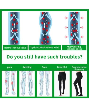 VARCOH Compression Socks - DVT & Varicose Veins Relief | Maternity & Pregnancy Support | Shin Splints & Edema Relief | Men & Women | Size L - Buy Online on GoSupps.com