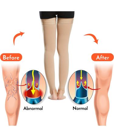 Leeofty 1 Pair Thigh High Socks Men Women 20-30mmHg Stockings Sleeves for Varicose Vein Swelling - Buy Online on GoSupps.com