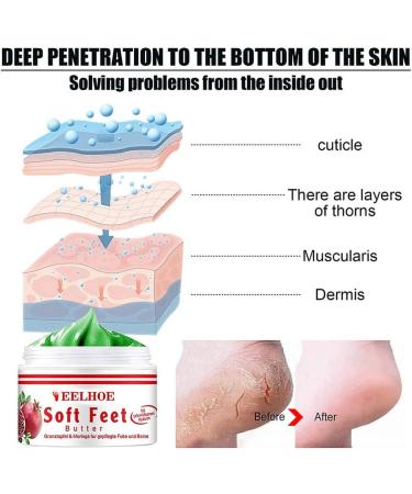 Frost Protection Cream for Feet | Anti-Crack Moisturizer & Dead Skin Foot Butter | Nourish & Repair with Effective Foot Care Cream - Buy Online on GoSupps.com