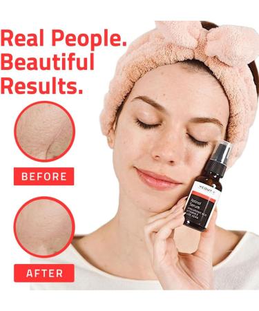 Retinol Serum for Face with Hyaluronic Acid Hydrating Face Serum Targets Wrinkles Dark Spots & Acne Anti Aging Facial Serum Skin Care Products for Men & Face Serum for Women by YEOUTH - Buy Online on GoSupps.com