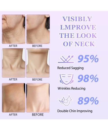 Tighten & Lift Neck Cream - 2024 Firming Solution for Sagging Skin | Neck Cream for Tightening & Lifting - Buy Online on GoSupps.com