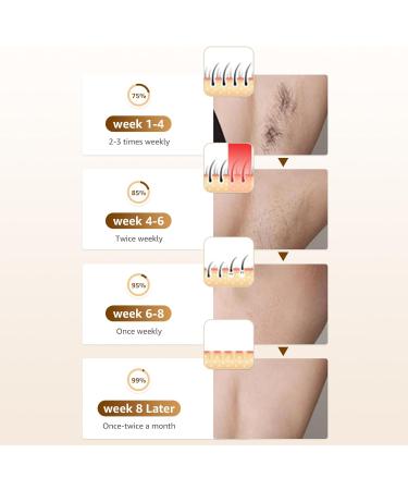 Rodzon IPL Laser Hair Removal Device - Painless Hair Remover for Women | Facial Armpits Legs Arms Bikini Line (Purple & White - Buy Online on GoSupps.com