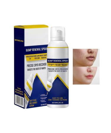 Soothing Face Spray - 60ml Herbal Quick Absorbing Moisturizing Face Mist - For Women Men Teens Young Adults and Family