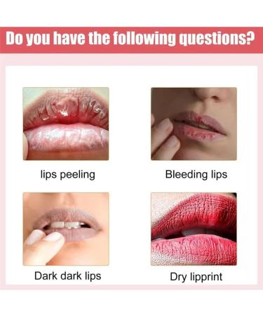 2PCS Lip Serum by Vitamin Extract Lip Lightening for Dark Lips Lip Balm Dark Lip Treatment for for Smokers and Non-smokers Lip Brightener for Dark Lips Fade Cream - Buy Online on GoSupps.com