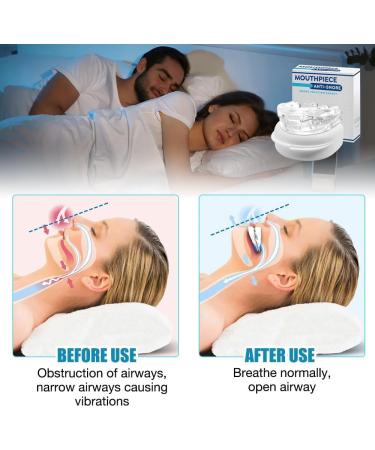 XPJBKC Adjustable Anti-Snoring Rails - 2pcs Snoring Stopper for Men & Women Comfortable Night Sleep - Buy Online on GoSupps.com