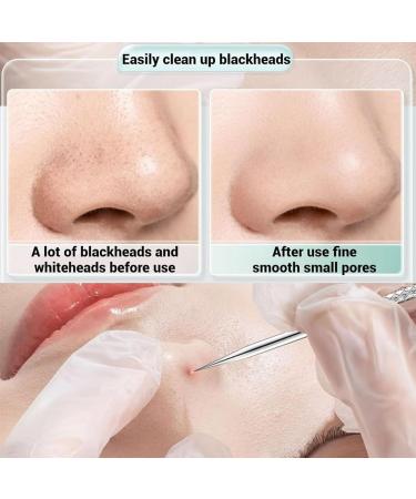 Usiveinborn Blackhead Remover 3/4/8Pcs Usiveinborn Tweezers Usiveinborn Stainless Stainless Steel Facial Blackhead Remover Tweezers Nose Face Blackhead Remover Tools with Packaging Box (3PCS) - Buy Online on GoSupps.com