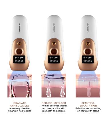 LESCOLTON IPL Hair Removal Device - 999,999 Flashes, Painless Laser Hair Removal for Men and Women - Epilation for Body and Face - Buy Online on GoSupps.com