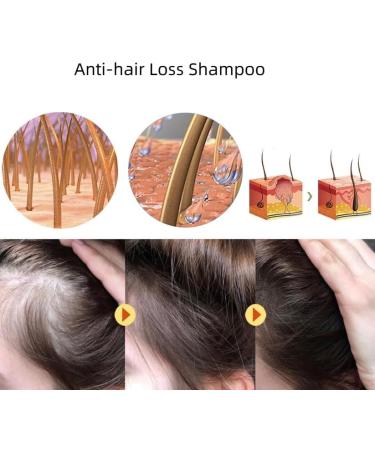 COALHO Antihair Loss Shampoo Antihair Loss and Hair Growth Shampoo Hair Thickening Shampoo for Men & Women Promote Hair Growth Anti hair Loss Shampoo 3pcs - Buy Online on GoSupps.com