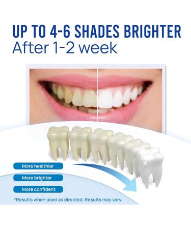 VieBeauti Teeth Whitening Pen - 2 Pcs | 20+ Uses | Painless No Sensitivity Travel-Friendly | Achieve a Beautiful White Smile | Mint Flavor - Buy Online on GoSupps.com