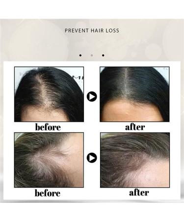 Rice Water Shampoo Bars Rice Water Solid Soap Shampoo Soap Extracted Handmade Natural Organic Soap Smooth Moisturizing Conditioner Shampoo Bars For Men And Women (3 Pcs) 1 g (Lot de 1) - Buy Online on GoSupps.com