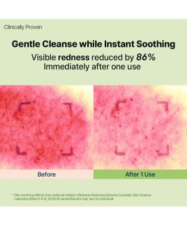 DearMYDEW HYCICA Soothing Gentle Cleansing Foam | Low pH 5.5 Cleanser for Sensitive Skin Calming Hydrating Cica Face Wash & Barrier Care Centella Ultra-Low Molecular HA Korean Skincare 5.07 fl oz - Buy Online on GoSupps.com