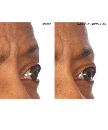 SiO Beauty Mid-Brow Forehead Anti-Wrinkle Patch - Overnight Silicone Patch for Furrows, Expression Lines, and 11s - Buy Online on GoSupps.com