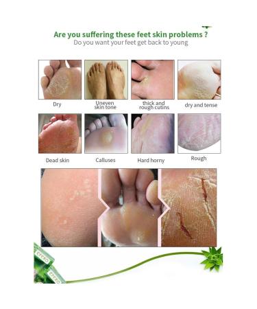 Xuejian Aloe Vera Foot Mask Socks - Exfoliating Peeling Socks for Pedicure & Callus Removal - Buy Online on GoSupps.com