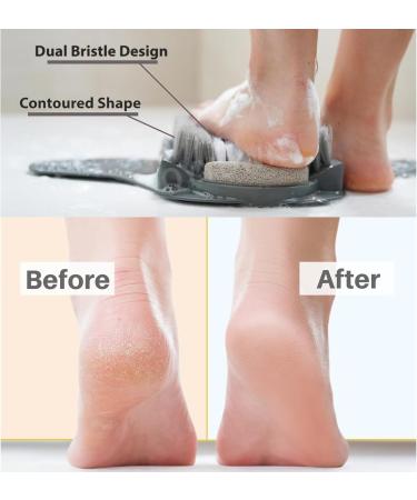 Shower Foot Scrubber Mat - 10 in 1 Foot File & Callus Remover with Non-Slip Suction Cups | Pumice Stone Foot Scraper for Dead Skin Care - Buy Online on GoSupps.com