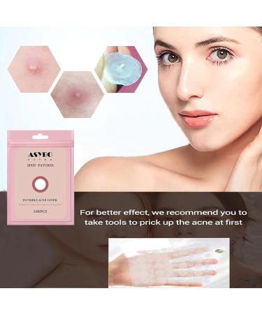 Buy Acne Patches - Invisible Hydrocolloid Spot Stickers for Fast Healing | 108 Translucent Pimple Patches Two Sizes Available - International Shipping - Buy Online on GoSupps.com