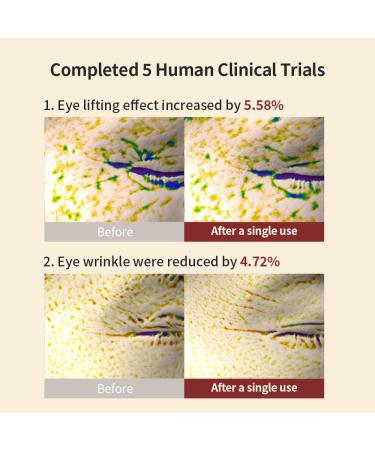 BQCELL Lipotox Core Cream 50g | Anti-Aging Moisturizer with Stem Cell Extract for Firming & Wrinkles | K-Beauty Skincare Made in Korea - Buy Online on GoSupps.com