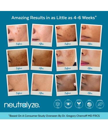 Brightening Dark Spot Corrector for Face | Maximum Strength Acne Dark Spot Remover Serum | Melasma Treatment with Vitamin C, Niacinamide & Arbutin | Fade Cream for 90+ Days - Buy Online on GoSupps.com