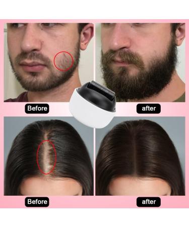 Gohytal 0.5 mm Derma Roller for Hair Premium Microneedling for Home with 1200 Titanium Tips for Face Body & Hair Loss and Secret Corner & Beard Treatment - Buy Online on GoSupps.com