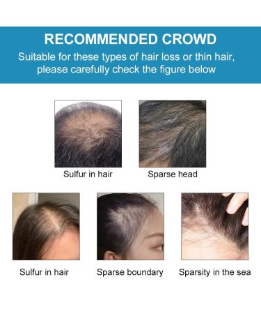 Instant Hair Volume Powder for Men & Women - Invisible Hair Sealing & Concealing Solution - Black - Anti-Hair Loss - Buy Online on GoSupps.com