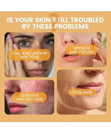 3PCS Whitening Freckles Serum Stick Remove Melesmas Dark Spots Melanin Pigmentation Lighten Brighten Face Cream - Buy Online on GoSupps.com