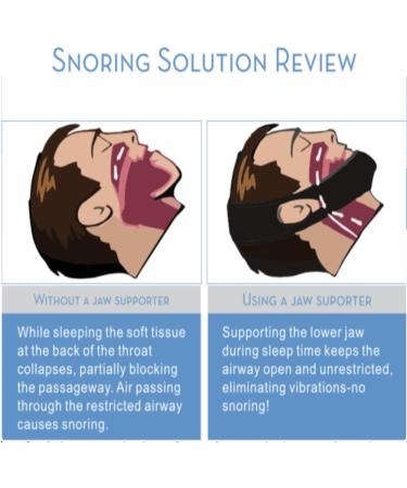 Fixsoma Anti Snoring Chin Strap with Adjustable Jaw Support - Snoring Solution for Men, Women & Kids - Includes Silk Eye Mask & Nasal Strips - Buy Online on GoSupps.com
