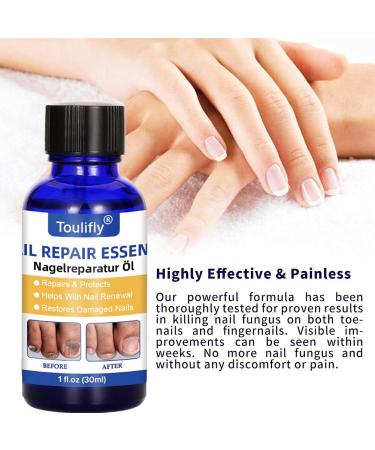 Maximum Strength Nail Repair Solution - Repairs and Protects Fingernails and Toenails from Discoloration, Brittle and Cracks - 1 Fl Oz - Buy Online on GoSupps.com