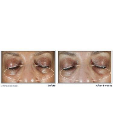 RoC Multi Correxion Even Tone + Lift Eye Cream Brightening & Dark Circle Solution Anti Aging Eye Formula Reduces Fine Lines & Wrinkles - 15 ml - Buy Online on GoSupps.com