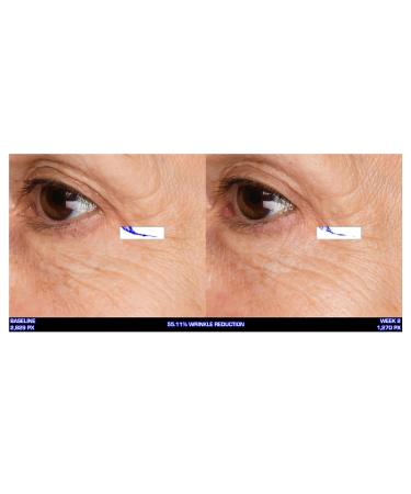 Serious Skincare Ultra-Mare Revitalizing Eye Cream - Marine Peptides & Minerals - 0.5 oz (1 pack) - Buy Online on GoSupps.com