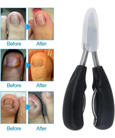 Guanshang1 Toenails Trimmer Toenail Clippers for Ingrown or Thick Nails Cuticle Nipper Trimmer Toenail Nipper for Seniors with Protective Cover Stainless Steel Nail Scissors for Ingrown Hard Toe Nail - Buy Online on GoSupps.com
