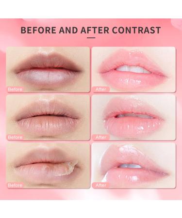 Dr.YIMAN Sugar Lip Scrub Exfoliator for Dry, Chapped Lips - Moisturizing Strawberry Lip Care Treatment - Buy Online on GoSupps.com