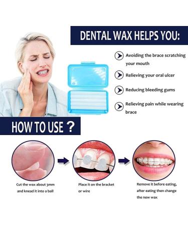 Dental Wax for Braces - Mint Orthodontic Wax (1 Box, 50 Uses) - Buy Online on GoSupps.com