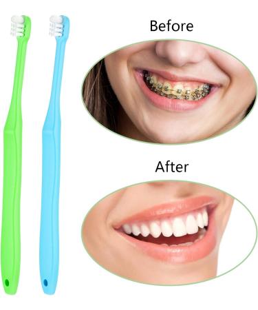 WLLHYF 2 Pack Orthodontic Toothbrush - Very Soft Tufted Toothbrush for Braces & Detail Cleaning | Blue & Green - Buy Online on GoSupps.com