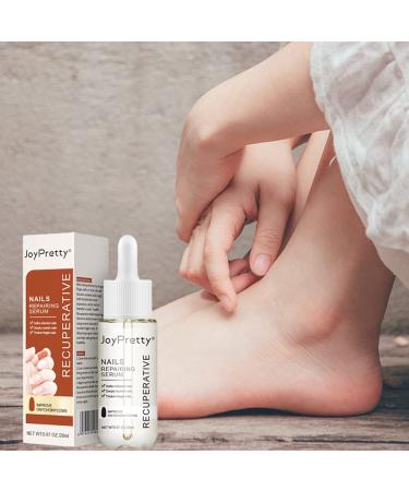 Lurrose Nail Repairing Serum 20ml - Onychomycosis Softening Solution for Discolored Nails - Nails Treatment Oil for Damaged Nails - Buy Online on GoSupps.com