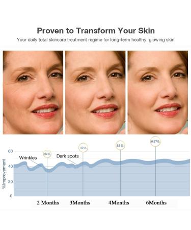 NEWKEY Red Light Therapy Mask - 7 LED Light Therapy for Face Wrinkles | At-Home Anti-Aging Skin Care & Beauty Mask - Buy Online on GoSupps.com