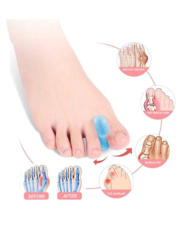 HHSEYEWELL Cracked Heel Lotion with Bunion Toe Corrector - Toe Spacer & Straightener for Foot Care - 0.53oz Pack of 1 - Buy Online on GoSupps.com