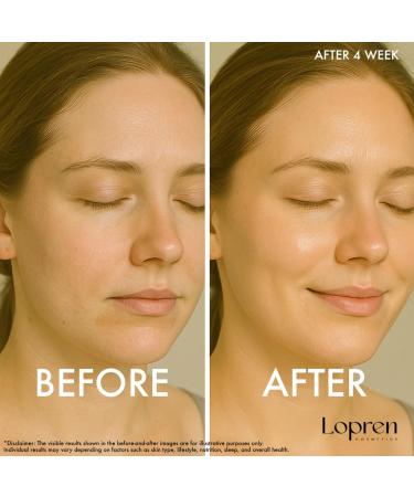 Lopren Glycolic Acid 7% & Vitamin C Brightening Duo Set Exfoliating Toner & Hydrating Serum for Uneven Skin Tone Dark Spots & Dullness 8.4 Fl Oz & 1 Fl Oz - Buy Online on GoSupps.com