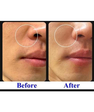 ULTIMATE Retinoid Cream 0.4% | Line Lifting & Rejuvenation Concentrate | 30ml | International Shipping - Buy Online on GoSupps.com