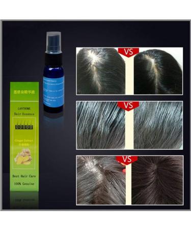 Hair Care Essence - Lanthome Fast Hair Growth & Regrowth Treatment for Men & Women | Anti Hair Loss Chinese Formula - Buy Online on GoSupps.com