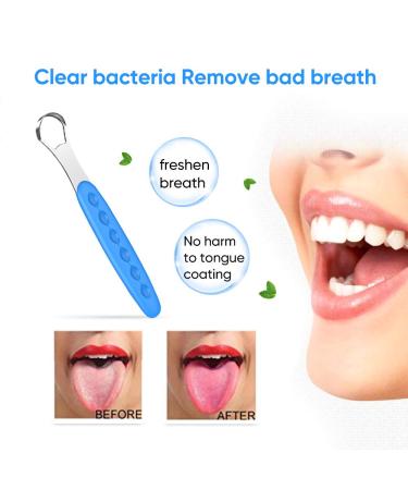 Metal Tongue Scraper Cleaner Set for Adults & Kids - Fresh Breath Dental Care (2 pcs) - Blue & Green Case - Buy Online on GoSupps.com
