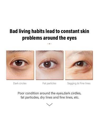 Buy Retinol Eye Cream with AHA & BHA - Dark Circles & Puffy Eyes Treatment | Anti-Aging Instant Eye Tightener for Men & Women - International Shipping - Buy Online on GoSupps.com