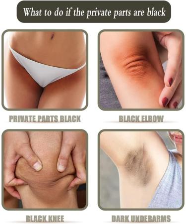 Acanthosis Nigricans Treatment Bamboo Charcoal Soap Activated Charcoal Black Bar Soap Dark Spot Remover Soaps Suitable for Any Part (3 pcs) - Buy Online on GoSupps.com