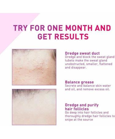 ZHBiwmatn 2024 New 4Pcs Milia Clearing Essence Milia Remover Eye Serum Milia Remover Milia Spot Treatment Miliary Repair Essence Moisturize Skin Improve Skin Texture for All Skin Types 30ml/1.8fl.oz - Buy Online on GoSupps.com