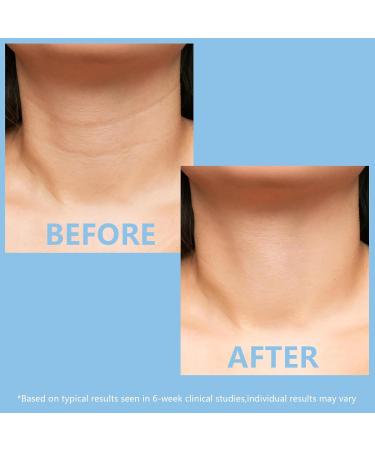 KISSIO 5% Collagen Neck Cream - Firming Lifting & Hydrating Peptide Cream for All Skin Types - 2.12 Oz - Buy Online on GoSupps.com
