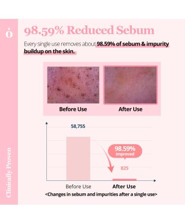 Ongredients Pore Cleansing Pad - Exfoliating Face Wipes & Makeup Remover - Korean Cleansing Pads for Pore Reducing - 60 Pads - Buy Online on GoSupps.com