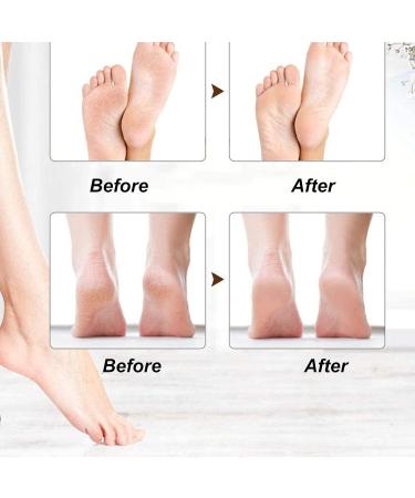 Professional 3pcs Foot Grinder Head Set Exfoliating & Softening Replacement Accessories for Salon & Home Use | Best for Men - Buy Online on GoSupps.com