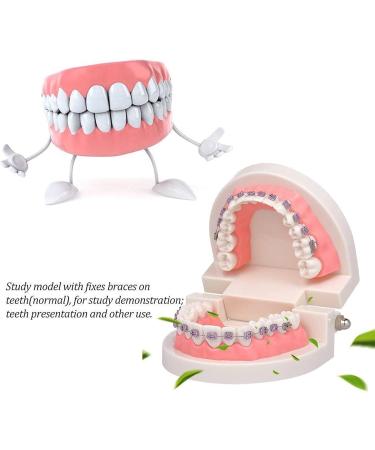Dytah Orthodontic Demonstration Model - Teeth Study Model with Metal Arch Wire & Brackets for Effective Teaching - Buy Online on GoSupps.com