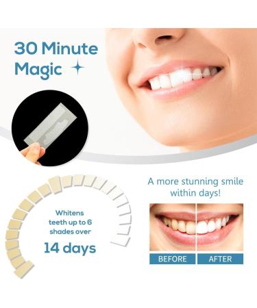 Advanced Teeth Whitening Strips + Crest 3D Brilliance Toothpaste - Professional White Smile Kit - Buy Online on GoSupps.com