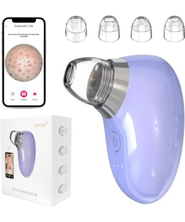 Pore Vacuum with Camera for Blackhead Removal - Real-Time Pore Minimizer and Acne Treatment Tool (Purple) - Buy Online on GoSupps.com